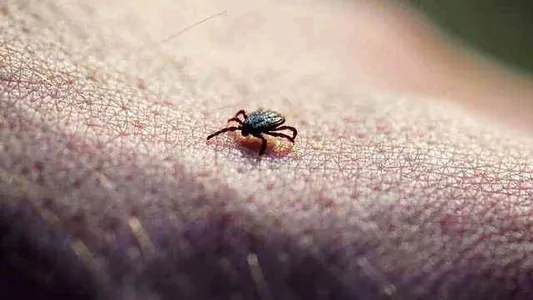 Китайские ученые обнаружили новый вирус, который передается через укусы клещей