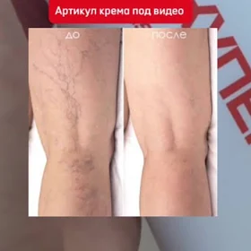 krem gyzyl damarlar